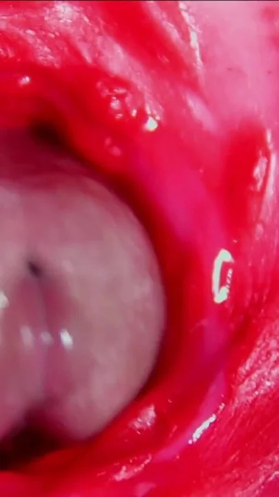 móc lỗ đít — ảnh 43